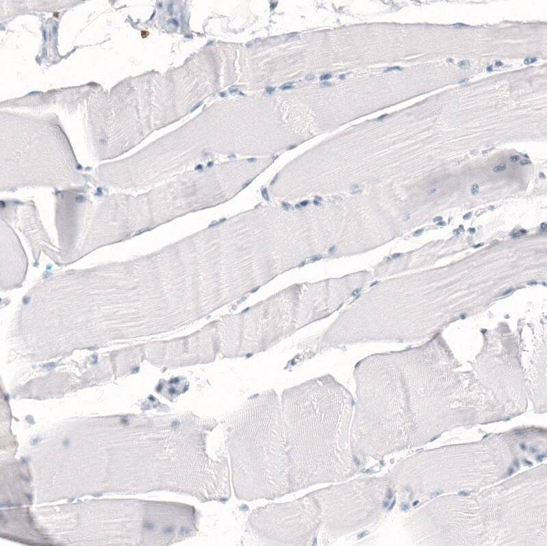 Staining of human skeletal muscle shows no positivity in myocytes as expected.