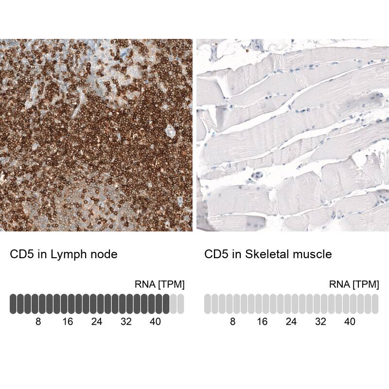 Analysis in human lymph node and skeletal muscle tissues using NBP3-44269 antibody. Corresponding CD5 RNA-seq data are presented for the same tissues.