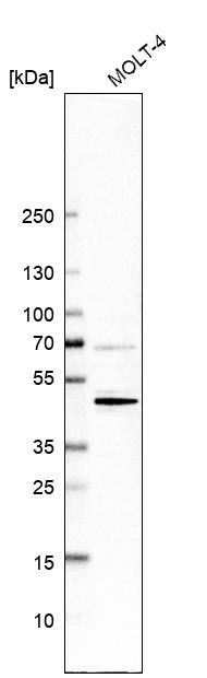 Analysis in human cell line MOLT-4.