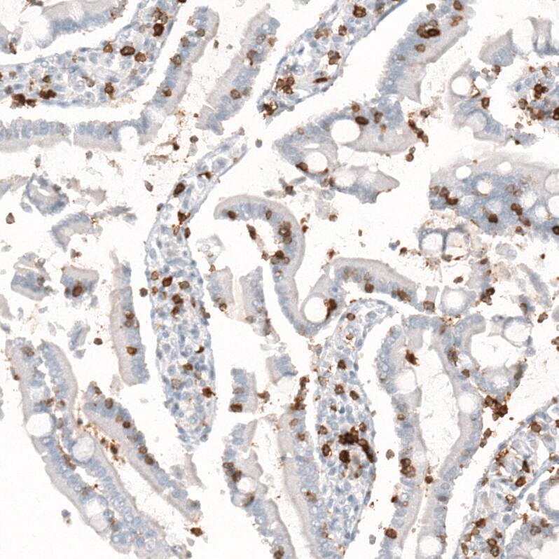 Staining of human small intestine shows strong membranous positivity in lymphoid cells.