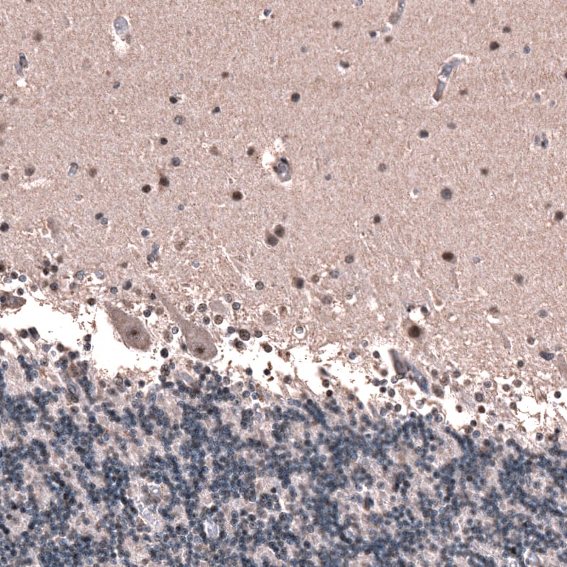 Staining of human cerebellum shows nucleolar positivity in Purkinje cells, as well as nuclear positivity in a subset of neurons in the molecular layer.