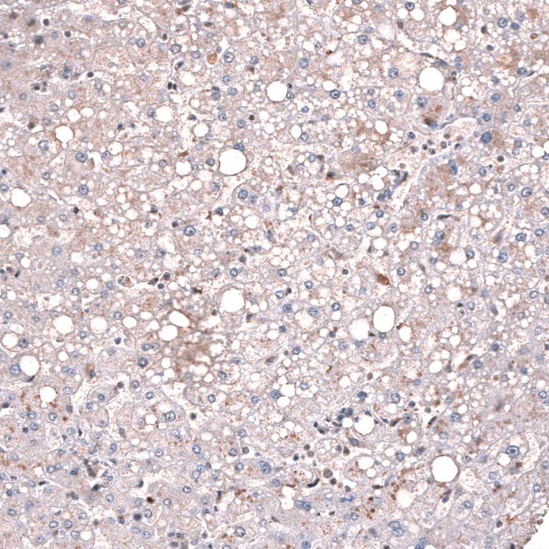 Staining of human liver shows no nuclear positivity in hepatocytes as expected.