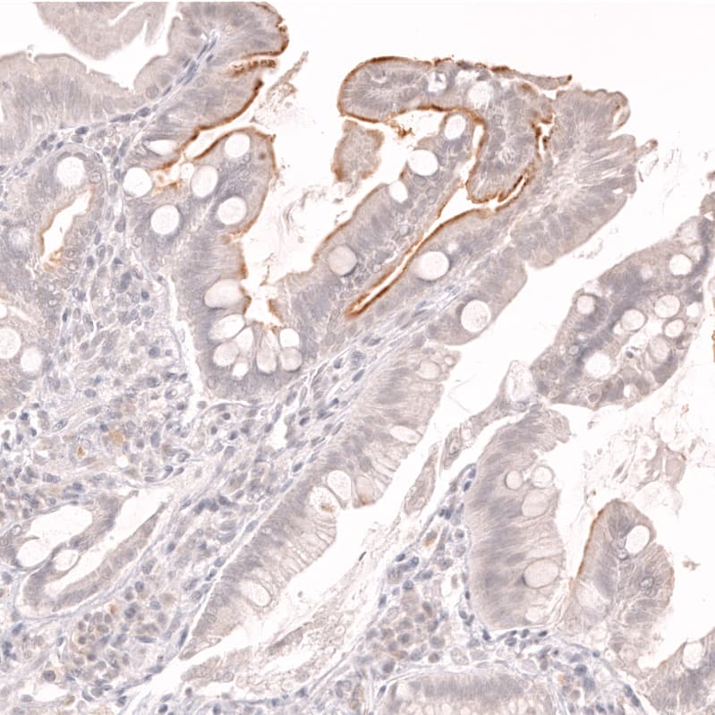 Staining of human duodenum shows moderate membranous positivity in the intestinal brush border.