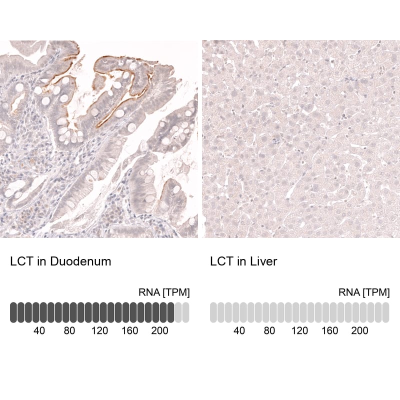 Analysis in human duodenum and liver tissues using NBP3-44272 antibody. Corresponding Lactase RNA-seq data are presented for the same tissues.