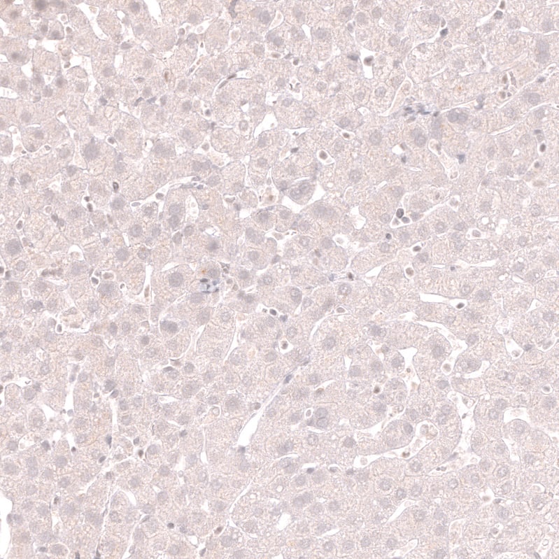 Staining of human liver shows no positivity in hepatocytes as expected.