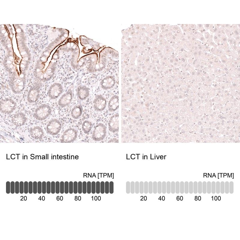 Analysis in human small intestine and liver tissues using NBP3-44273 antibody. Corresponding Lactase RNA-seq data are presented for the same tissues.