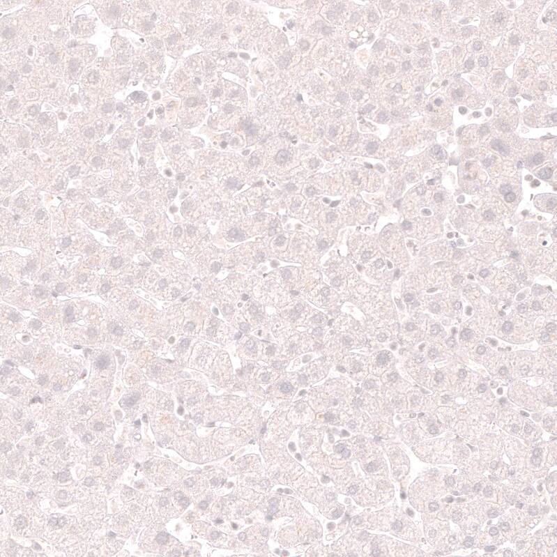 Staining of human liver shows no positivity in hepatocytes as expected.