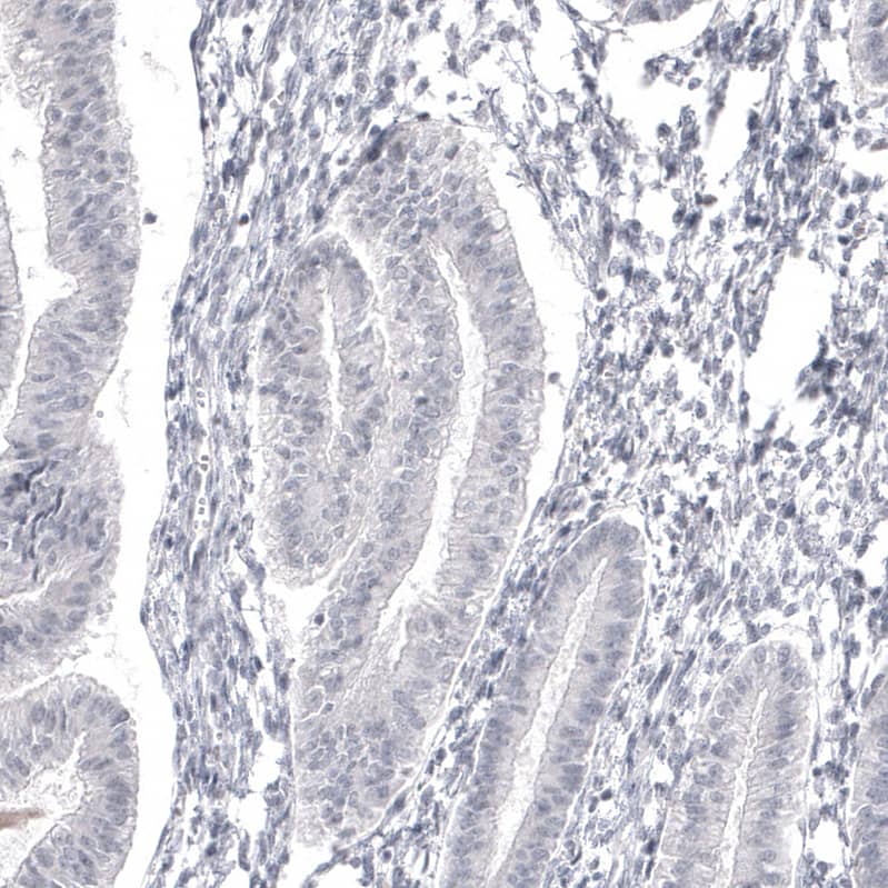 Staining of human endometrium shows no positivity in glandular cells as expected.