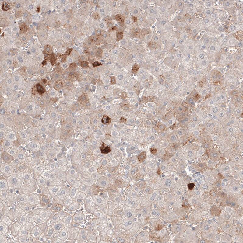 Staining of human liver shows weak to moderate cytoplasmic positivity in hepatocytes.