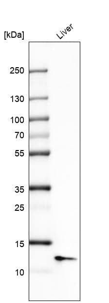 Analysis in human liver tissue.