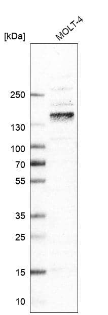 Analysis in human cell line MOLT-4.
