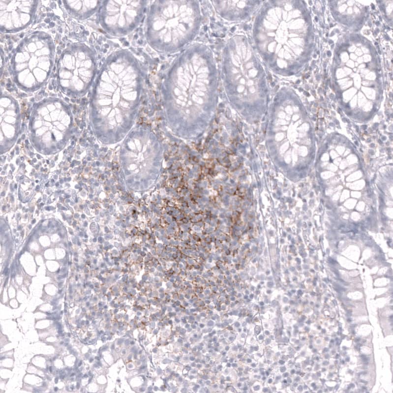 Staining of human small intestine shows strong membranous positivity in lymphoid cells.