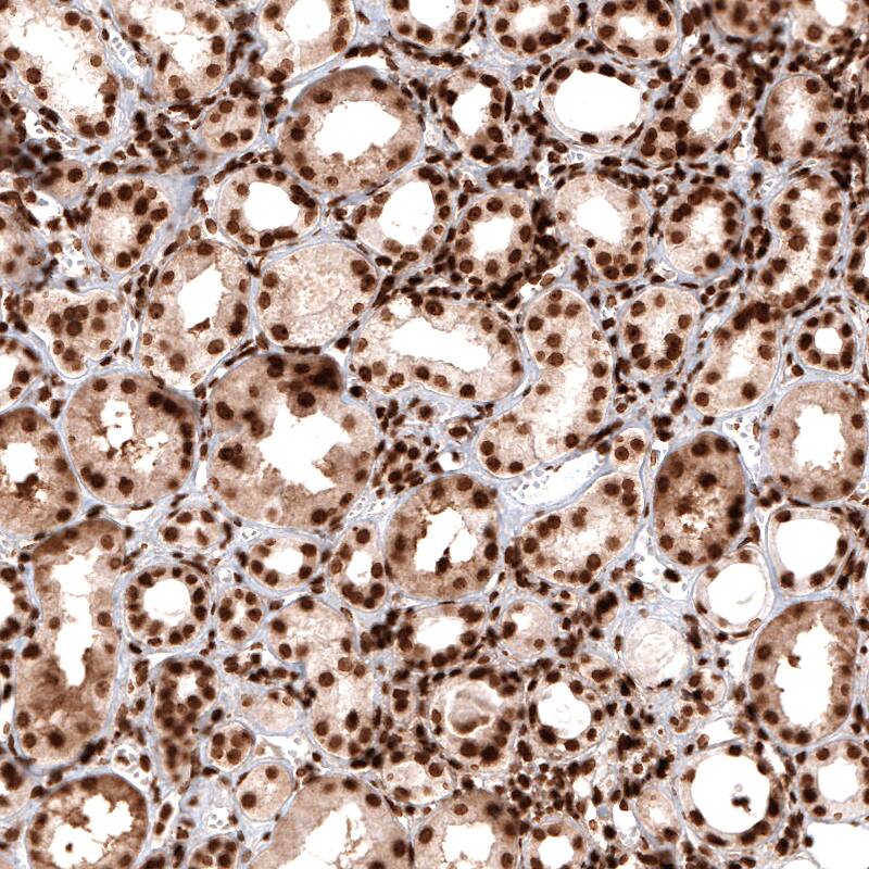 Staining of human kidney shows strong nuclear positivity in renal tubules cells.