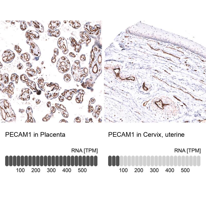 Analysis in human placenta and cervix, uterine tissues using NBP3-44280 antibody. Corresponding CD31/PECAM-1 RNA-seq data are presented for the same tissues.