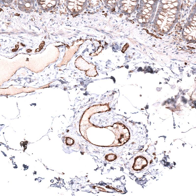 Staining of human colon shows strong membranous positivity in endothelial cells.