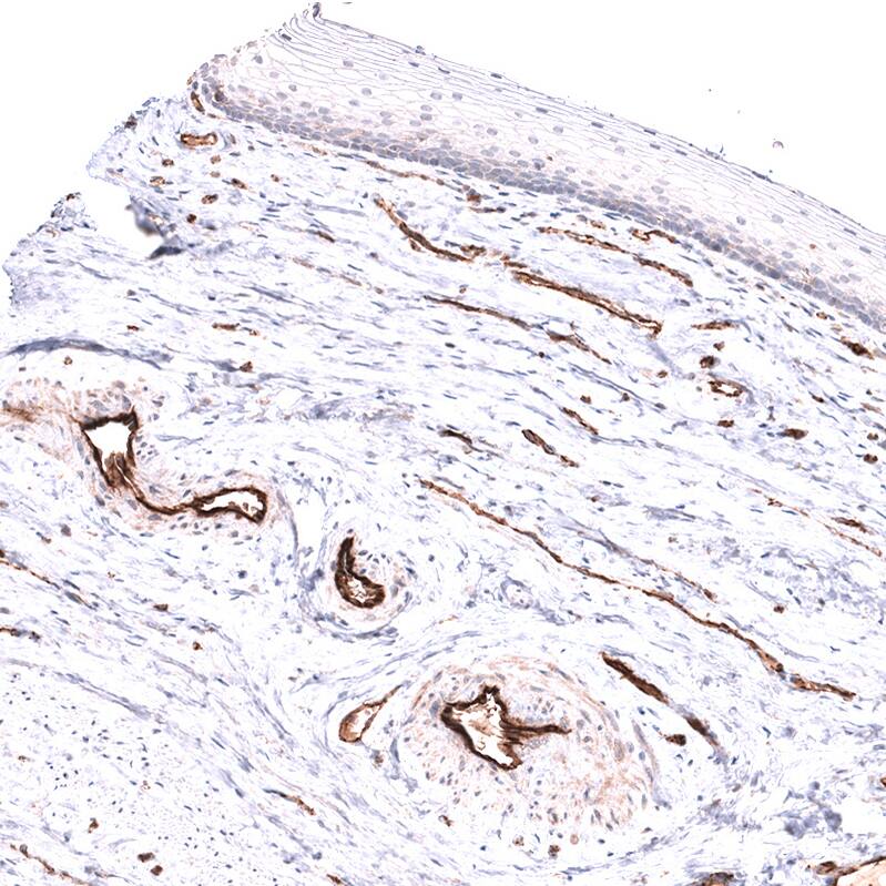 Staining of human cervix, uterine shows strong membranous positivity in endothelial cells.