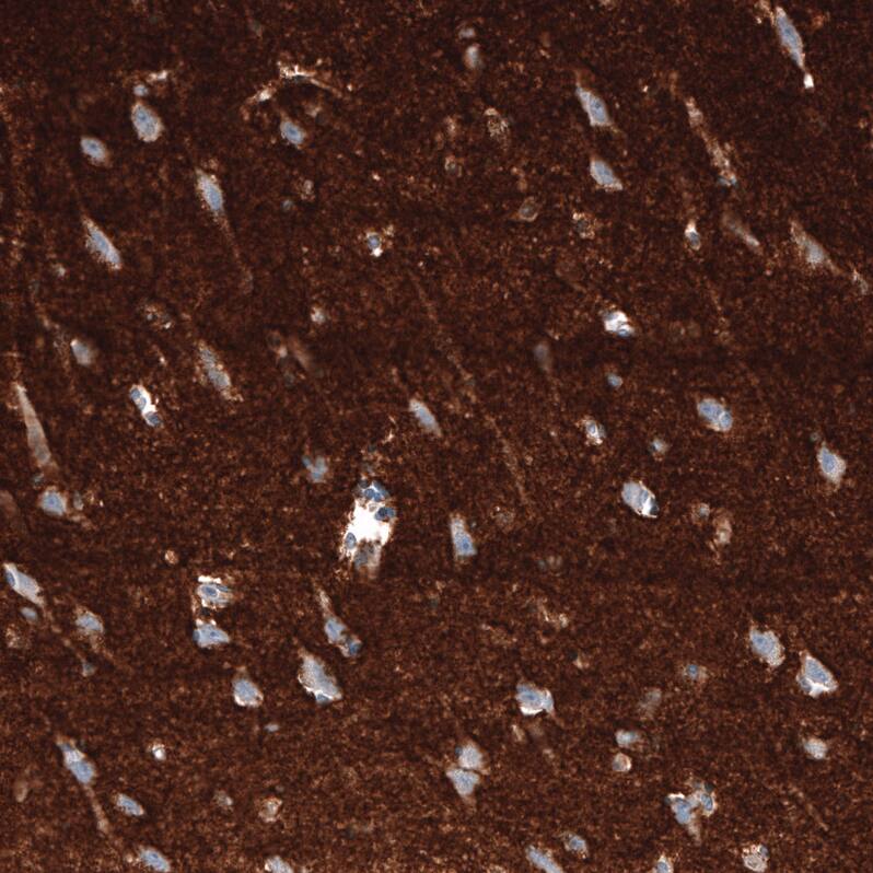 Staining of human cerebral cortex shows strong positivity in neuronal processes in neuropil.