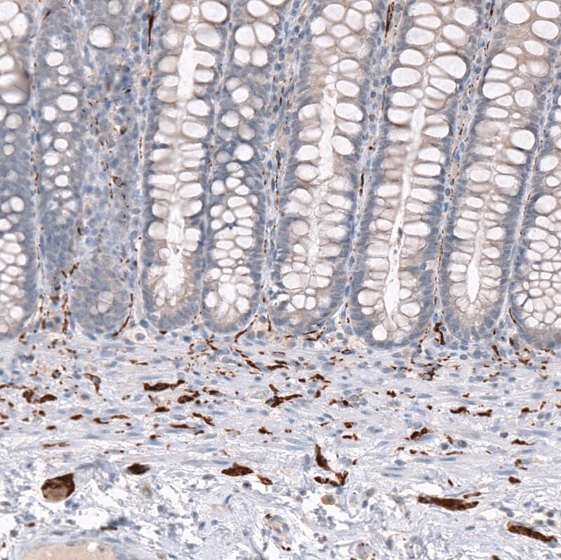 Staining of human rectum shows strong positivity in peripheral ganglia and nerves.