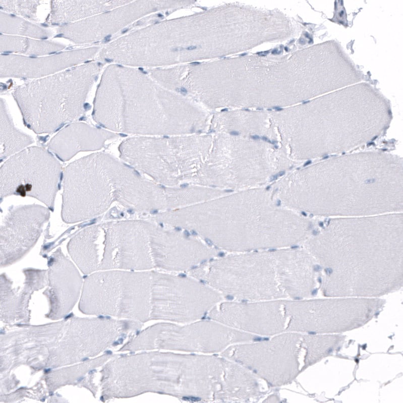 Staining of human skeletal muscle shows no positivity in myocytes.