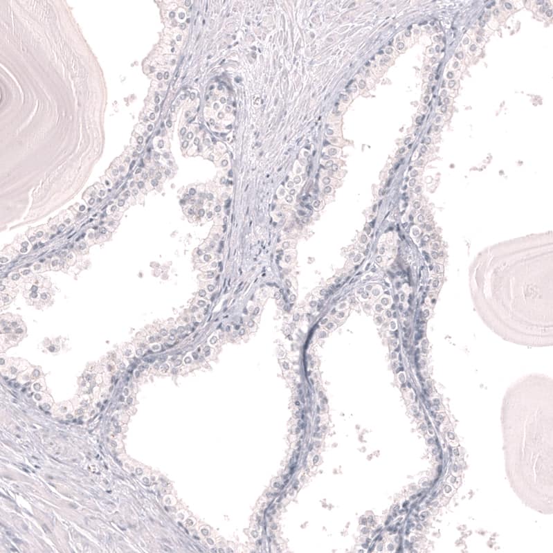 Staining of human prostate shows no positivity in glandular cells and smooth muscle cells as expected.