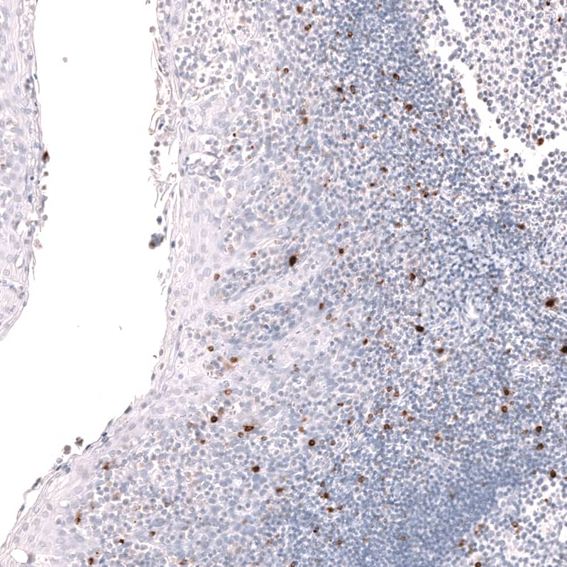 Staining of human tonsil shows strong cytoplasmic positivity in non-germinal center cells and germinal center cells.