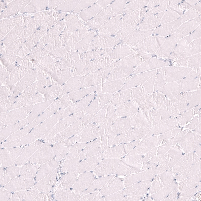 Staining of human skeletal muscle shows no positivity in myocytes as expected.