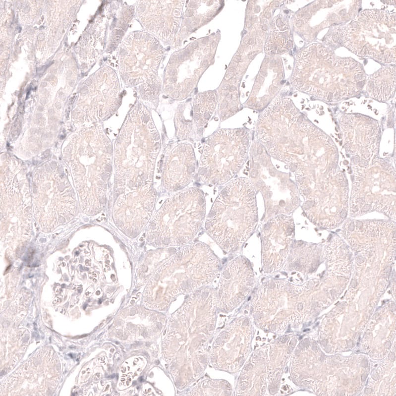 Staining of human kidney shows no positivity in cells in tubules as expected.
