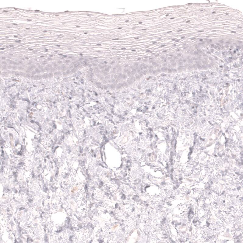 Staining of human uterine cervix shows no positivity in squamous epithelial cells as expected.