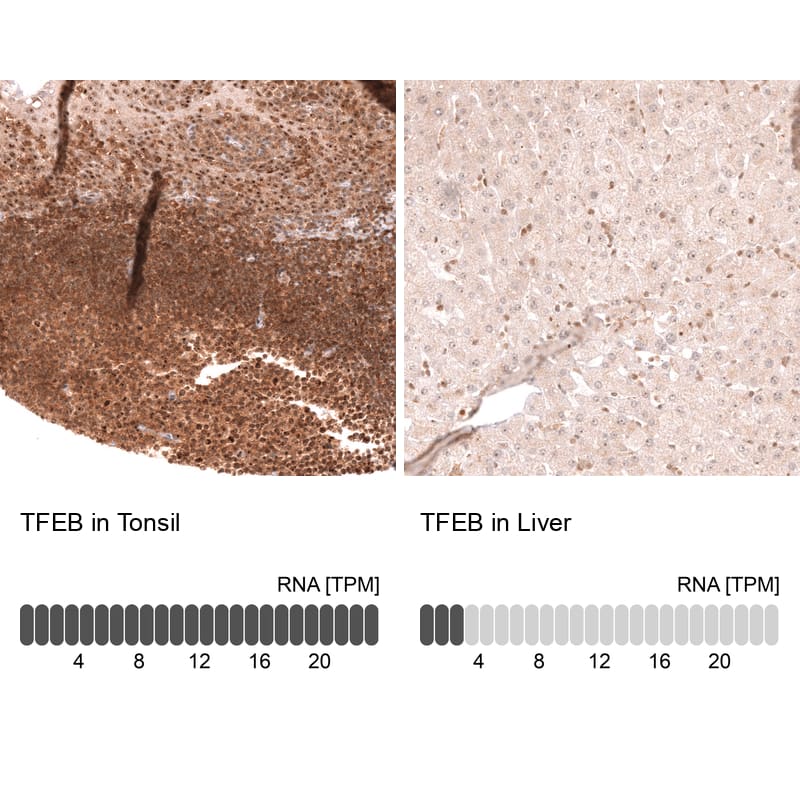 Analysis in human tonsil and liver tissues using NBP3-44287 antibody. Corresponding TFEB RNA-seq data are presented for the same tissues.