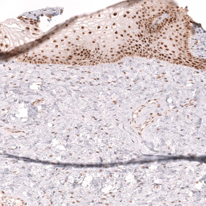 Staining of human cervix shows strong nuclear positivity in squamous epithelial cells.