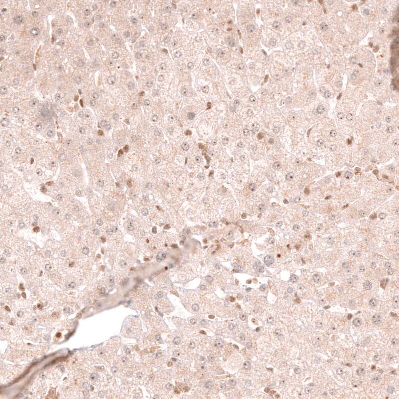 Staining of human liver shows very weak positivity in hepatocytes.