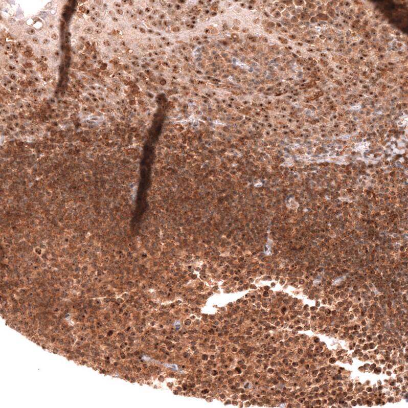 Staining of human tonsil shows strong nuclear and cytoplasmic positivity in non-germinal center cells.