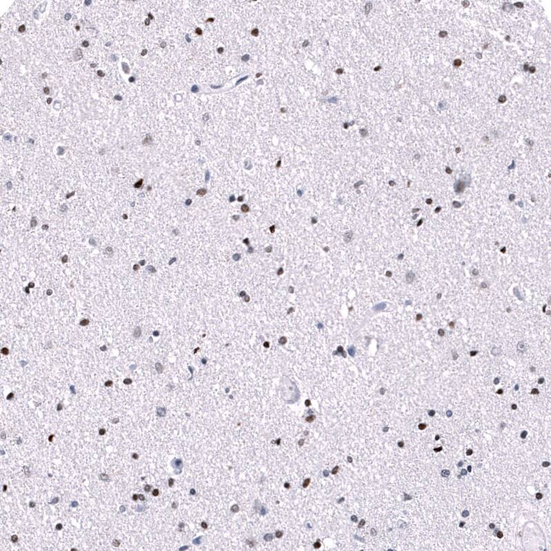 Staining of human cerebral cortex shows moderate to strong nuclear positivity in neurons and glial cells.