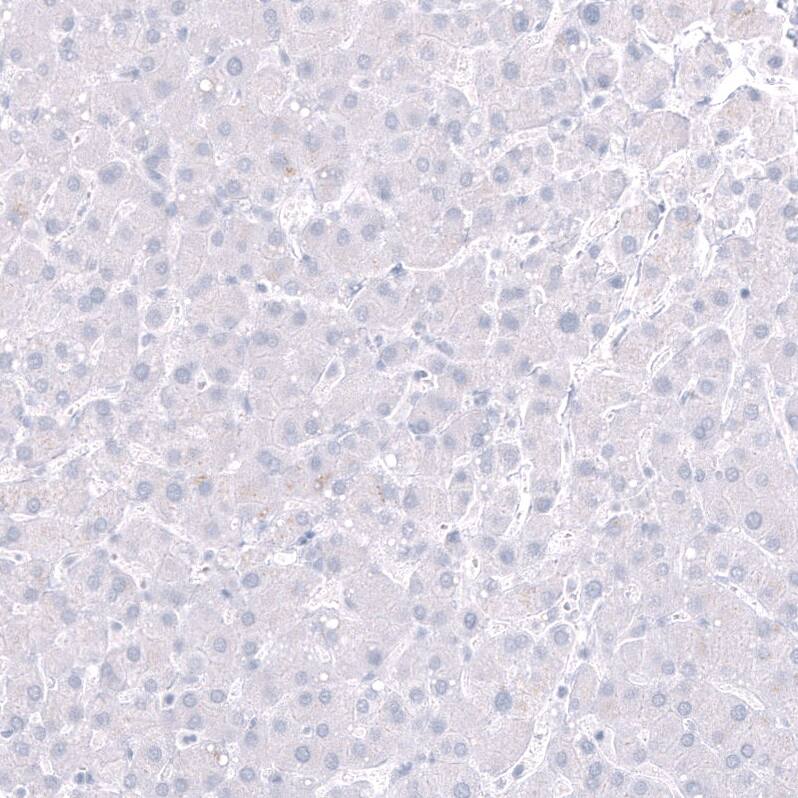 Staining of human liver shows no positivity in hepatocytes as expected.