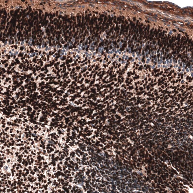 Staining of mouse embryo, E14 shows strong nuclear positivity in neurons in developing cerebral cortex.