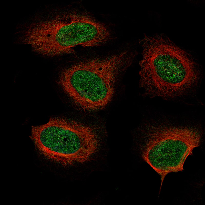 Staining of U-2 OS cells using the Anti-Neurofibromin 1 monoclonal antibody, showing specific staining in nucleoplasm in green. Microtubule probe is visualized in red.