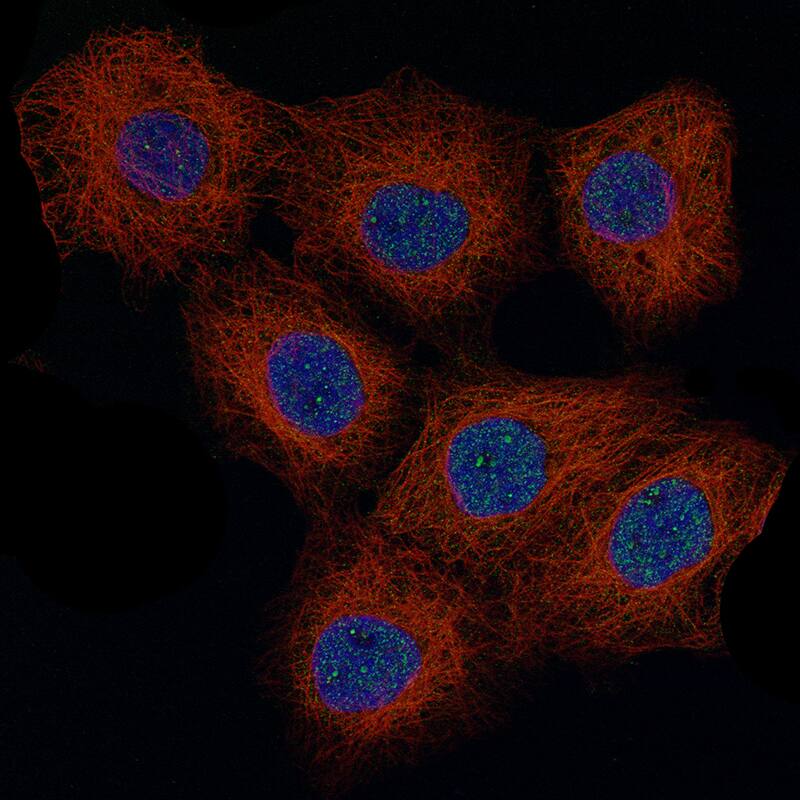 Immunofluorescence staining of A-431 cells using the Anti-CCND1 monoclonal antibody, showing localization in nuclear speckles and nucleoli fibrillar center in green. Microtubule- and nuclear probes are visualized in red and blue, respectively.