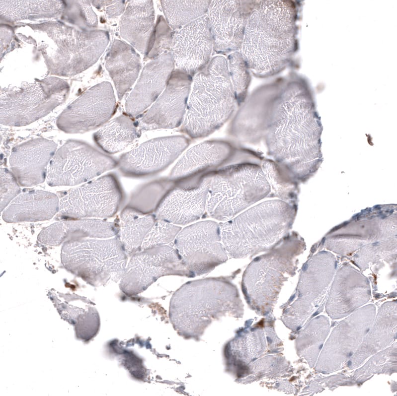 Staining of human skeletal muscle shows no positivity in myocytes as expected.