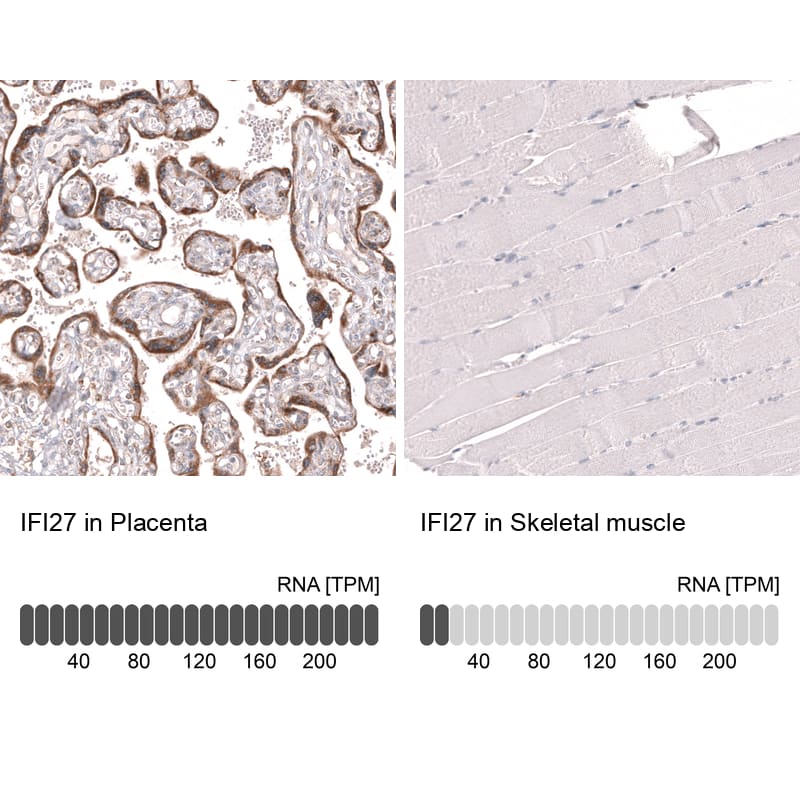 Analysis in human placenta and skeletal muscle tissues using NBP3-44299 antibody. Corresponding IFI27 RNA-seq data are presented for the same tissues.