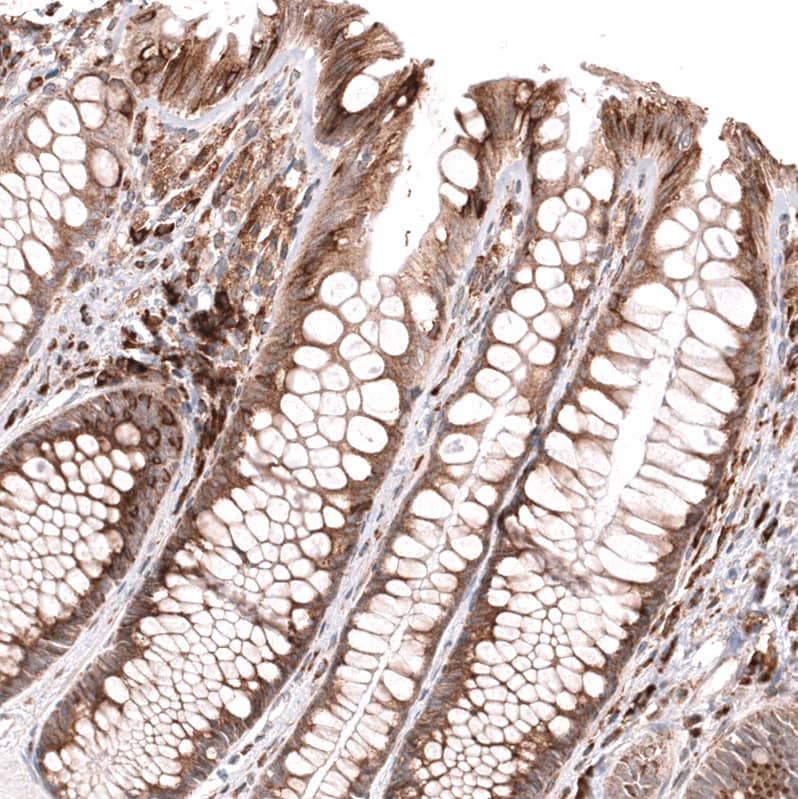 Staining of human colon shows moderate cytoplasmic positivity in glandular cells.