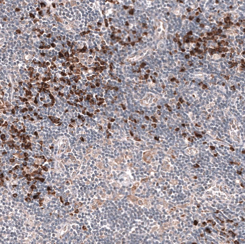 Staining of human lymph node shows strong cytoplasmic positivity in lymphoid cells.