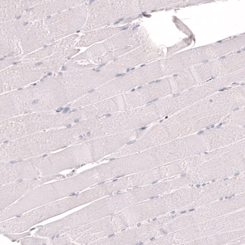Staining of human skeletal muscle shows no positivity in myocytes as expected.