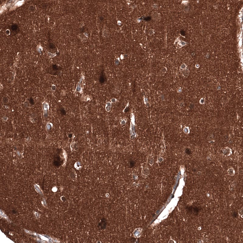 Staining of human cerebral cortex shows strong nuclear positivity in neurons.