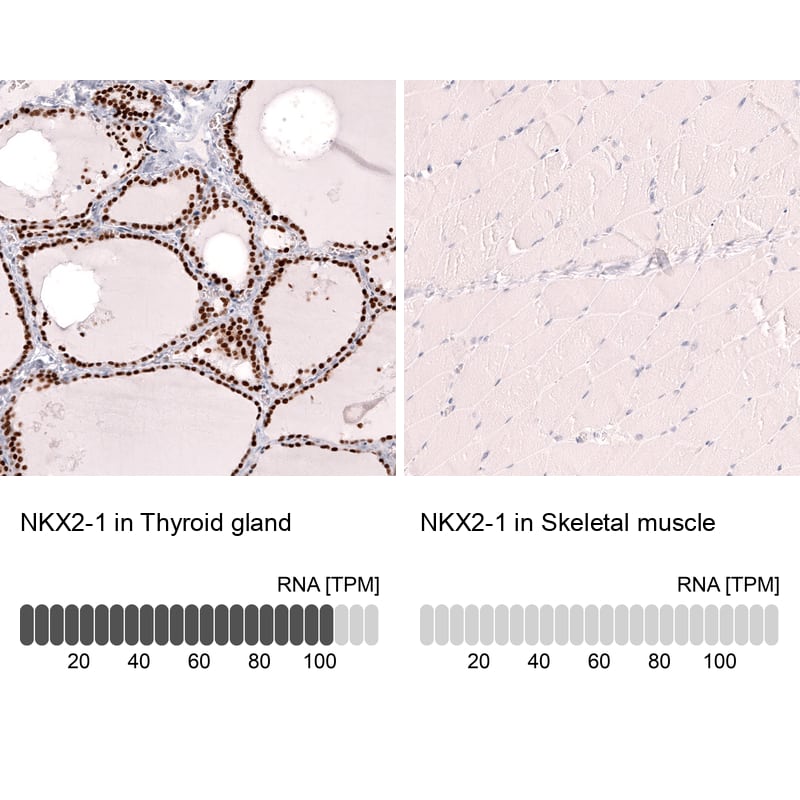 Analysis in human thyroid gland and skeletal muscle tissues using NBP3-44302 antibody. Corresponding TTF-1 / NKX2-1 RNA-seq data are presented for the same tissues.
