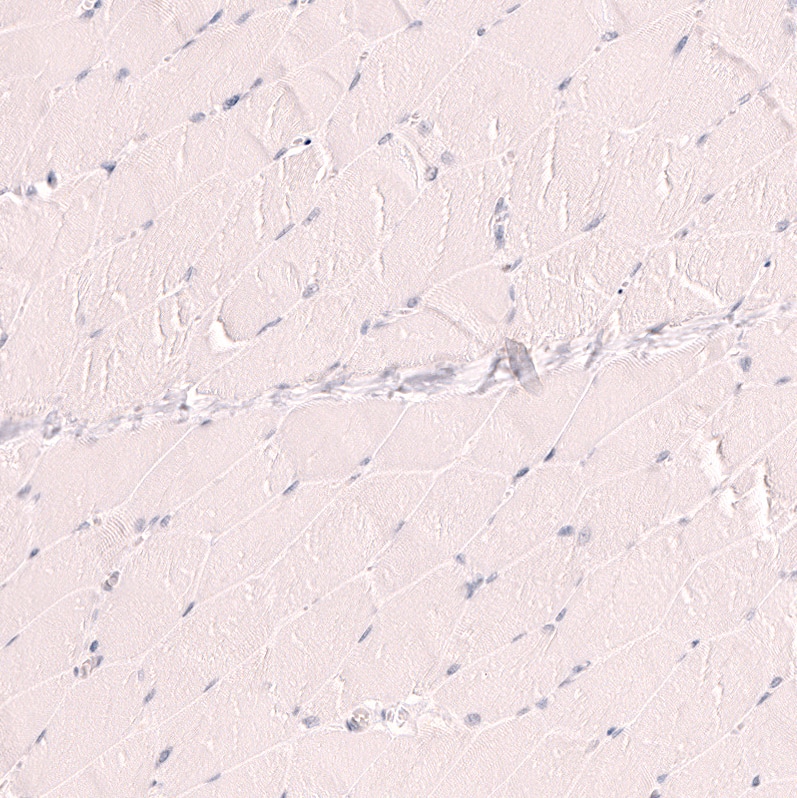 Staining of human skeletal muscle shows no positivity in myocytes as expected.