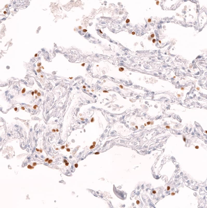 Staining of human lung shows strong nuclear positivity in a subset of pneumocytes.