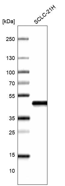 Analysis in human cell line SCLC-21H.