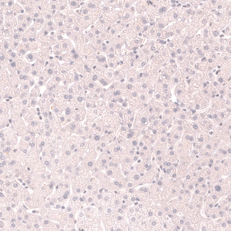Staining of human liver shows no positivity in hepatocytes as expected.