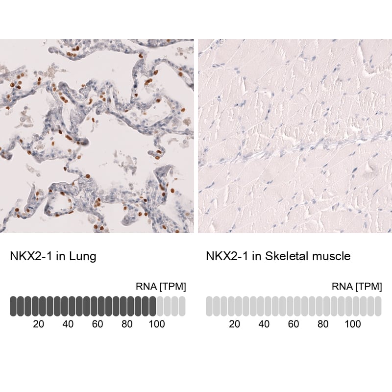 Analysis in human lung and skeletal muscle tissues using NBP3-44304 antibody. Corresponding TTF-1 / NKX2-1 RNA-seq data are presented for the same tissues.