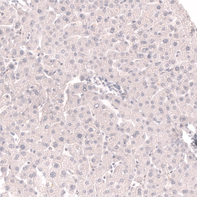 Staining of human liver shows no positivity in hepatocytes as expected.